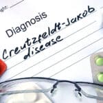 Elder Care in Simpsonville SC: What is Creutzfeldt-Jakob Disease?