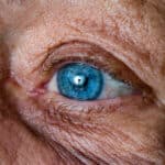 Macular Degeneration: Senior Home Care Greenville SC