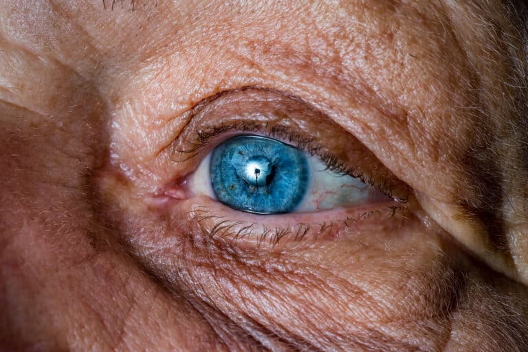 Macular Degeneration: Senior Home Care Greenville SC